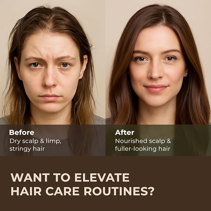 Gya Labs Rosemary Essential Oil for Hair - Huge 4 Fl Oz - 100% Pure Natural Rosemary Oil for Scalp, Diffuser, Skin, Aromatherapy & Candle Making Scent-HomvellaHome