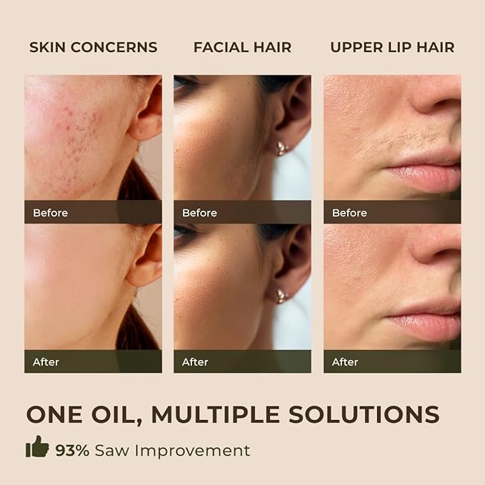 Gya Labs Spearmint Essential Oil for Facial Hair - Huge 4 Fl Oz - 100% Pure Natural Spearmint Oil for Diffuser, Skin, Massage, Aromatherapy & Candle Making Scent-HomvellaHome