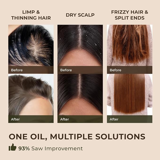 Gya Labs Rosemary Essential Oil for Hair - Huge 4 Fl Oz - 100% Pure Natural Rosemary Oil for Scalp, Diffuser, Skin, Aromatherapy & Candle Making Scent-HomvellaHome