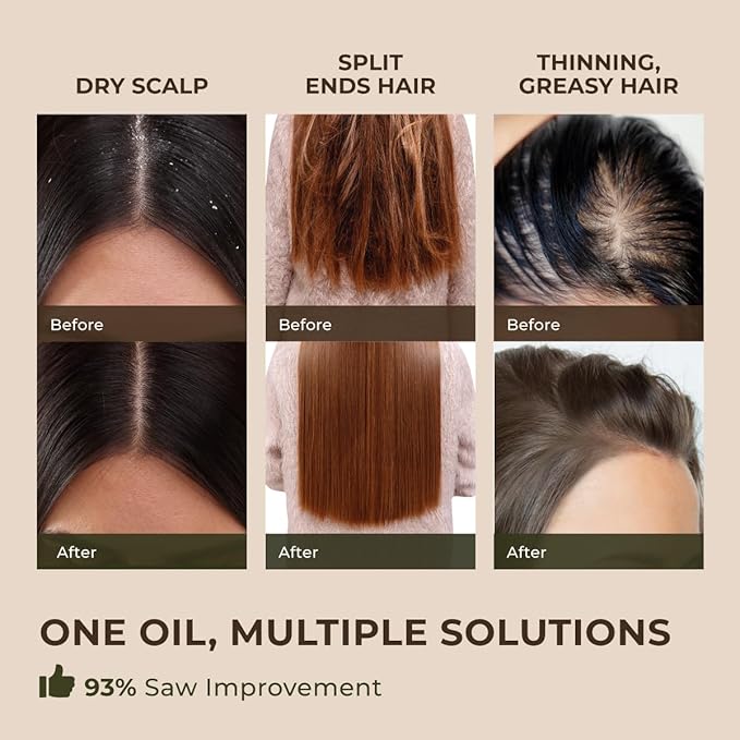 Gya Labs Peppermint Essential Oil for Diffuser & Hair - Huge 4 Fl Oz - 100% Pure Natural Peppermint Oil for Skin, Face, Body, Self-Care, Aromatherapy & Candle Making Scent-HomvellaHome