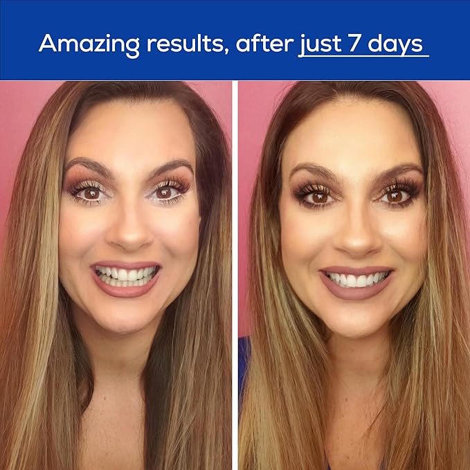 GLO Science Teeth Whitening Gel – 6% Hydrogen Peroxide – Clinically Proven, Fast & Safe for Sensitive Teeth – Includes 10 Gel Vials & 1 Lip Care-HomvellaHome