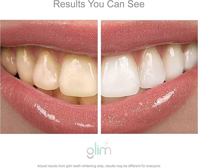 Glim Professional Teeth Whitening Strips| 42 Strips (21 Treatments), Hydrogen-Free, Peroxide-Free, Non-Toxic, Dentist Recommended, Sensitivity Free - Vegan & Cruelty Free - (Mint)-HomvellaHome
